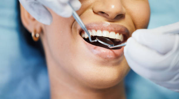 Best Emergency Dental Care for Sports Injuries in Wildwood Lake, TN